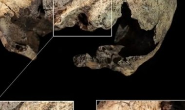 5300 yıllık kafatasında kulak ameliyatı izine rastlandı